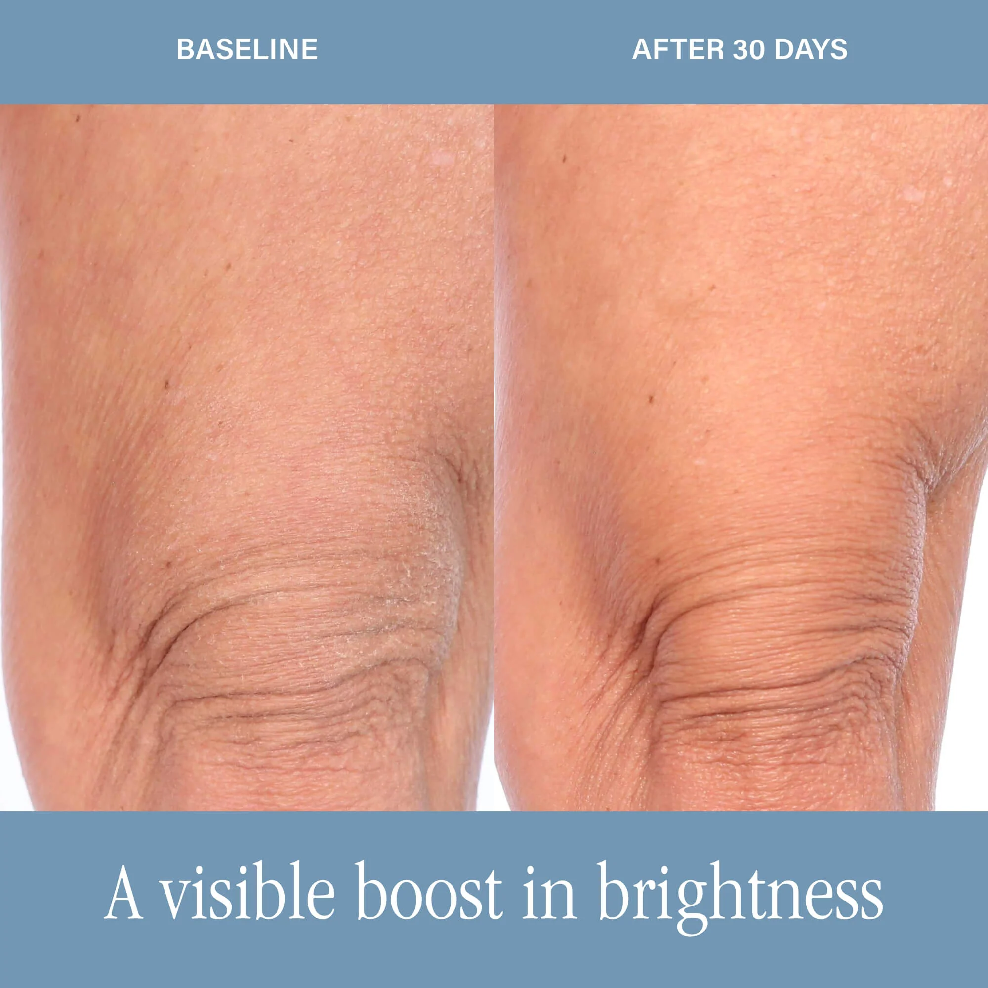 The Body Resurfacing Duo - Image 4