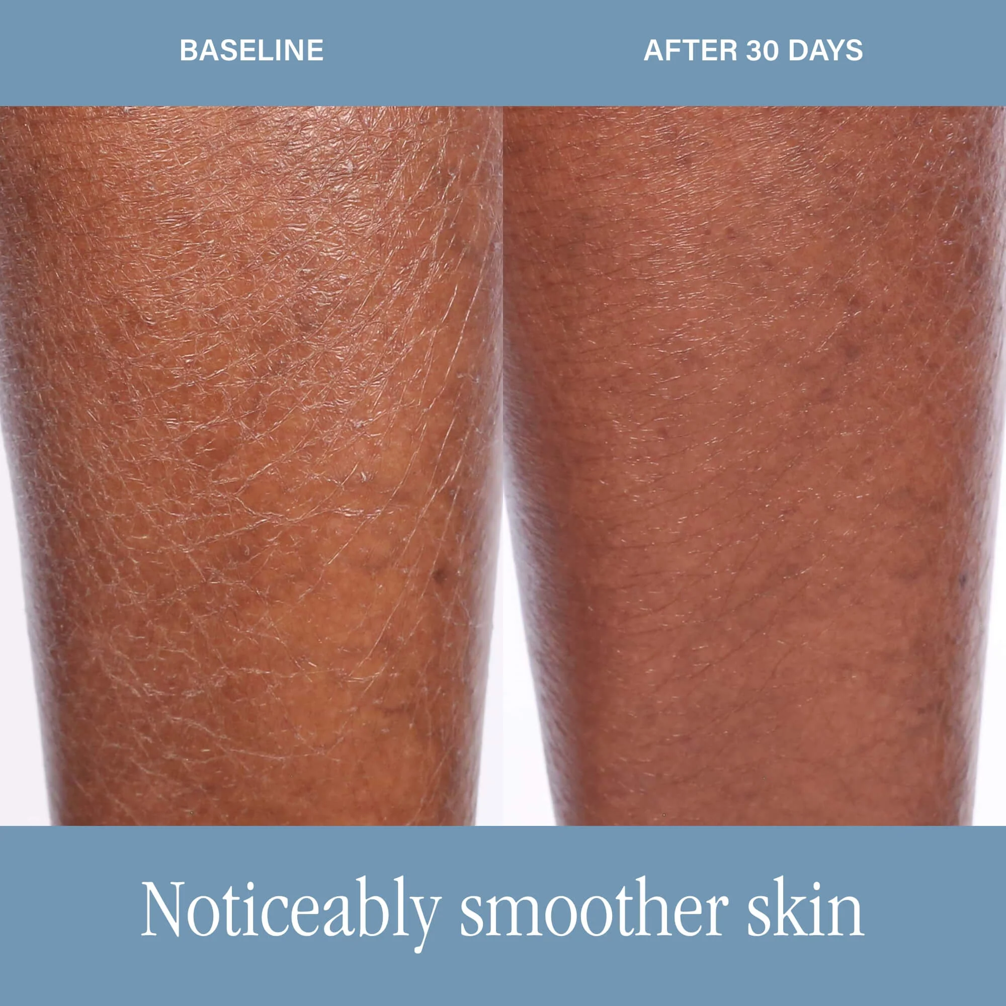 The Body Resurfacing Duo - Image 3